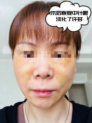 -素美医疗美容·西南眼鼻整形·修复基地