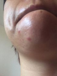 体验后-上海首尔丽格医疗美容医院