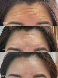 -弘美医美·艾维岚童颜抗衰中心