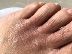 -中国人民解放军总医院