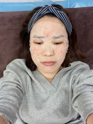 -洁铭新加坡医美