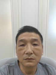 体验后-万州华美紫馨整形美容医院