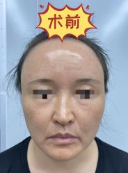 -素美医疗美容·西南眼鼻整形·修复基地