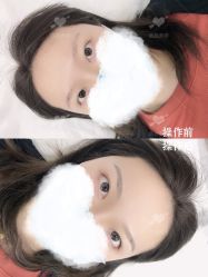 -西施无菌半永久纹绣眉眼影唇轻增发纹发际线