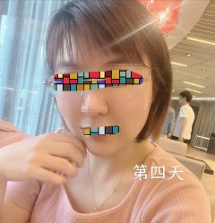-八大处整形
