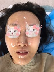 体验后-坤如玛丽·医疗美容中心