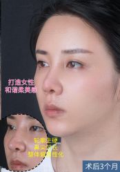 -北京米扬丽格医疗美容·联合丽格鼻整形中心