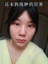 -素美医疗美容·西南眼鼻整形·修复基地