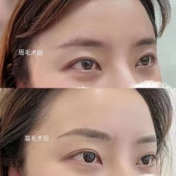 点击看大图 -Verywang半永久纹眉•仪器野生眉