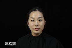 体验前-Yestar艺星整形
