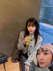 体验后-北京米扬丽格医疗美容·联合丽格鼻整形中心