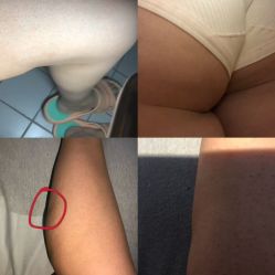 -洁铭新加坡医美