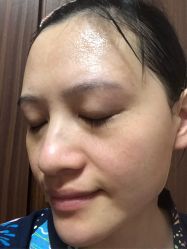 -荟草堂专业痘肌皮肤管理