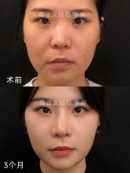 -北京米扬丽格医疗美容·联合丽格鼻整形中心