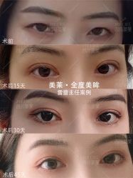 -美莱医学美容医院