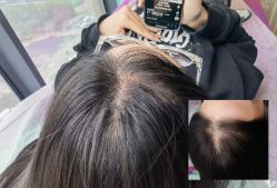 -西施无菌半永久纹绣眉眼影唇轻增发纹发际线