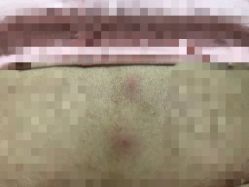 -松和日式美容整骨