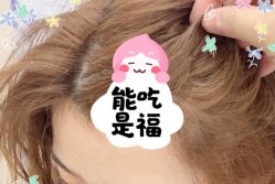 -大麦微针植发全国连锁