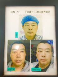 -紫洁俪方（北京）医疗美容