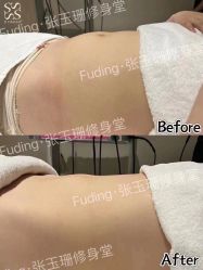 -Fundi张玉珊修身堂·indiba·BTL科技瘦身