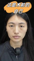 -素美医疗美容·西南眼鼻整形·修复基地