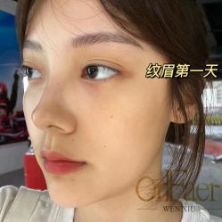 -OnFaer.纹眉半永久无创洗眉
