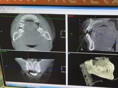 -土豆口腔(凤凰北总店)