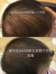 -希梵尔头皮抗衰·科技养发