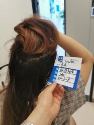 -大麦微针植发丨全国连锁