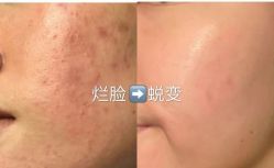 -Cream88颜皮肤管理中心