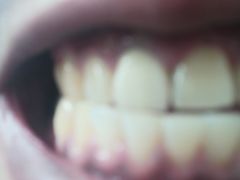 -Dr.Z dental仁康种植矫正中心