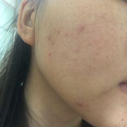 -痘院长·祛痘·皮肤管理