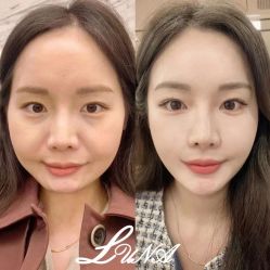 -LUNA皮相美·骨相美高级美感