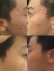 -皇族养心堂·净痘·修敏·御颜