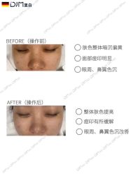 点击看大图 -半岛故事·法儿曼抗衰·indiba中心