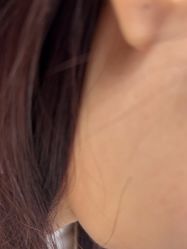 -美瑞莎创美医疗美容