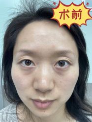 -素美医疗美容·西南眼鼻整形·修复基地