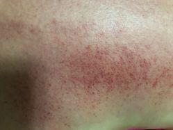 -周怡玲美容美体SPA