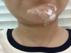 体验前-坤如玛丽·医疗美容中心