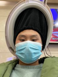 -碧莲盛·不剃发植发