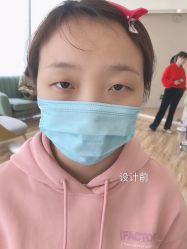 -久匠半永久纹眉
