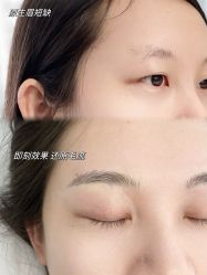 点击看大图 -张小野·专业半永久纹眉