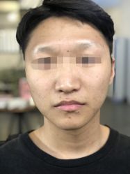 点击看大图 -痘博士广州·全国连锁祛痘机构