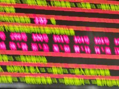 -重庆医科大学附属第一医院(本部)