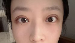 -画美医疗美容医院