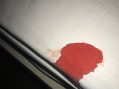 -广西医科大学第一附属医院