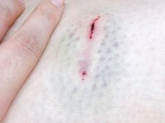 -上海市长宁区天山中医医院