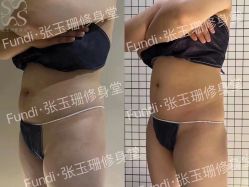 -Fundi张玉珊修身堂·indiba·BTL科技瘦身
