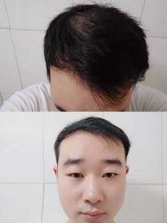 -雍禾植发全国连锁