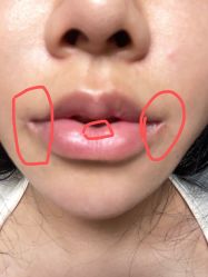 体验后-杭州米兰柏羽医疗美容医院